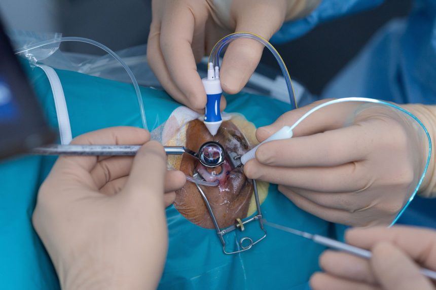 VITREO RETINAL PROCEDURES Retinal detatchment Surgery PPV and FGE and SOI and EL Single Eye