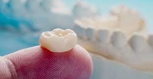 INDIVIDUAL CROWNS ZIRCONIA Metal Free Ceramic Crown