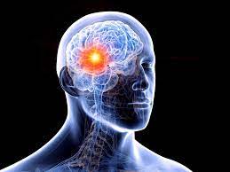 Brain Tumor Surgery