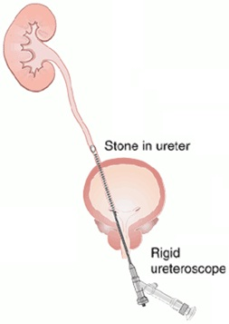 URS