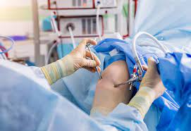 Knee Repair Surgery